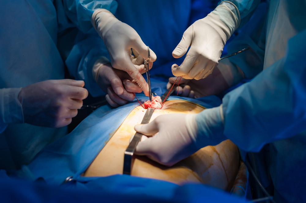 Can You Take Ozempic Without a Gallbladder?